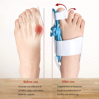 Adjustable Bunion Support Splint ��� Hallux Valgus Corrector for Men &