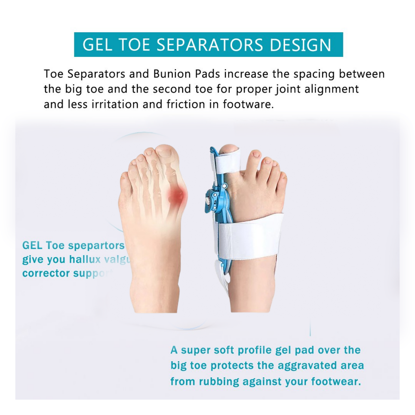 Adjustable Bunion Support Splint ��� Hallux Valgus Corrector for Men &